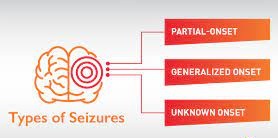 Three major groups of seizures